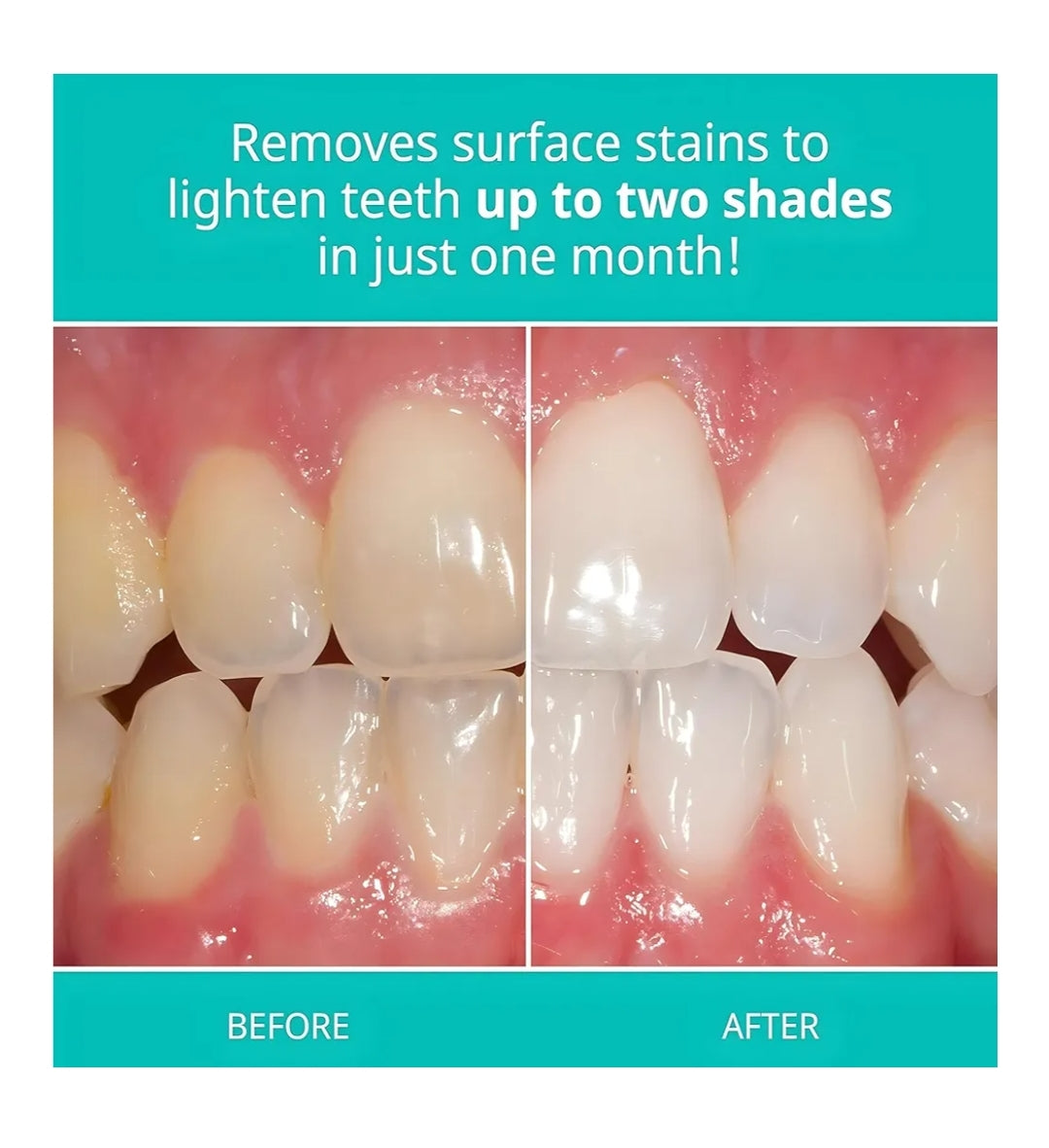 4.7 oz of Opalescence Whitening Toothpaste - Refreshing Cool Mint for Everyday Use"